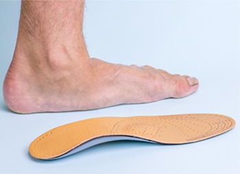 Flat Feet & Fallen Arches: When Custom Orthotics Aren’t Helping