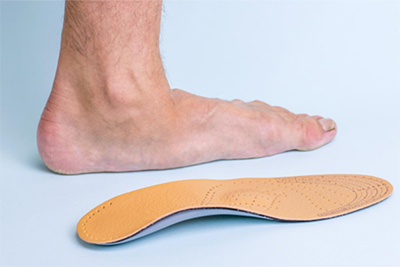 Flat Feet & Fallen Arches: When Custom Orthotics Aren’t Helping