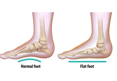 Foot & Ankle Anatomy | Foot Pain Naperville, Western Springs, IL ...